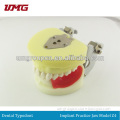 Dental implant practice jaw model